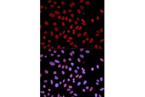 Immunofluorescence analysis of U2OS cell using PTPN6 antibody. (SHP1 Antikörper)