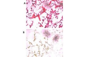 HE staining of frozen human ovarian cancer tissue reacted with the primary antibody at a 1:250 dilution. (UCHL5 Antikörper  (N-Term))