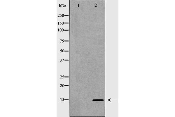 Norrie Disease (Pseudoglioma) Antikörper