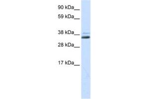 Western Blotting (WB) image for anti-Secreted Frizzled-Related Protein 1 (SFRP1) antibody (ABIN2463723) (SFRP1 Antikörper)