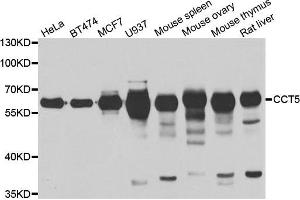 Western blot analysis of extracts of various cell lines, using CCT5 antibody.