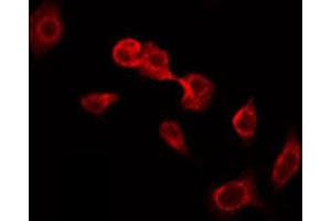 ABIN6274914 staining HeLa by IF/ICC. (Glucuronidase beta Antikörper  (Internal Region))