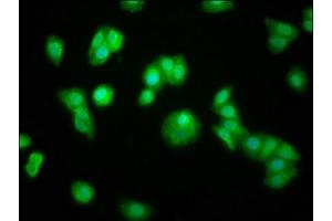 Immunofluorescence staining of HepG2 cells with ABIN7160260 at 1:100, counter-stained with DAPI. (ZFP36 Antikörper  (AA 16-103))