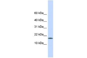 WB Suggested Anti-CENPA Antibody Titration:  0. (CENPA Antikörper  (Middle Region))