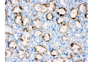 Immunohistochemistry (IHC) image for anti-Cytochrome P450, Family 1, Subfamily A, Polypeptide 1 (CYP1A1) (AA 183-320) antibody (ABIN3043819)