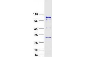 Validation with Western Blot (UTP3 Protein (Myc-DYKDDDDK Tag))