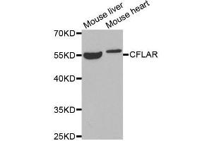 Western blot analysis of extracts of various tissues, using CFLAR antibody. (FLIP Antikörper  (AA 161-480))