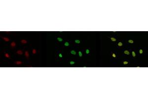 Immunofluorescence (IF) image for anti-Tumor Protein P53 (TP53) (acLys315) antibody (ABIN3201007) (p53 Antikörper  (acLys315))