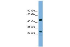 Image no. 1 for anti-Cell Division Cycle Associated 4 (CDCA4) (AA 143-192) antibody (ABIN6745604) (CDCA4 Antikörper  (AA 143-192))