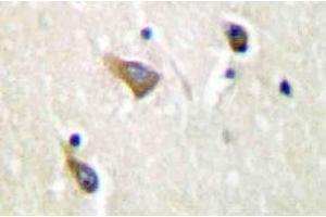 Immunohistochemistry (IHC) analyzes of Clusterin-alpha antibody in paraffin-embedded human brain tissue. (Clusterin Antikörper)