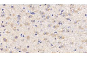 Detection of LCAT in Mouse Cerebrum Tissue using Polyclonal Antibody to Lecithin Cholesterol Acyltransferase (LCAT) (LCAT Antikörper  (AA 41-210))