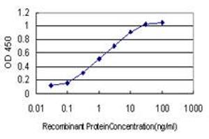 Detection limit for recombinant GST tagged LAMB3 is approximately 0. (Laminin beta 3 Antikörper  (AA 1064-1171))