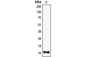 Western blot analysis of FHIT expression in HEK293T (A) whole cell lysates. (FHIT Antikörper  (Center))