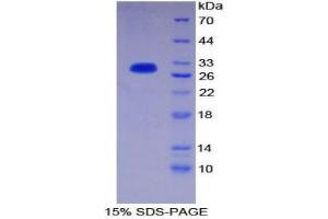 SDS-PAGE analysis of Human PIK3C2a Protein. (Phosphoinositide-3-Kinase, Class 2, alpha Polypeptide (PIK3C2A) Peptid)