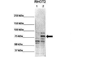 WB Suggested Anti-RHOT2 Antibody  Positive Control: Lane 1: 20ug untransfected HEK293T Lane 2: 20ug RHOT2 transfected HEK293T  Primary Antibody Dilution :  1:1000 Secondary Antibody : Anti-rabbit-HRP  Secondry Antibody Dilution :  1:2000 Submitted by: Jin-Mi Heo