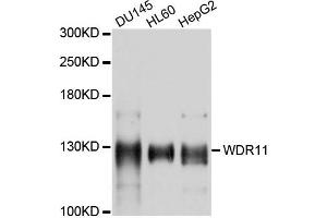 Western blot analysis of extracts of various cells, using WDR11 antibody. (WDR11 Antikörper)