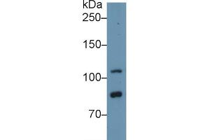 Western blot analysis of Human HeLa cell lysate, using Human TLR5 Antibody (1 µg/ml) and HRP-conjugated Goat Anti-Rabbit antibody (