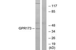 Western blot analysis of extracts from K562 cells, using GPR173 Antibody.