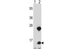 Western Blotting (WB) image for anti-High Mobility Group Nucleosome Binding Domain 1 (HMGN1) antibody (ABIN2997819) (HMGN1 Antikörper)