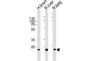 Western blot analysis of lysates from human brain , rat liver and lung tissue lysate (from left to right), using GSTT1 Antibody (N-term) (ABIN6244315 and ABIN6577396). (GSTT1 Antikörper  (N-Term))