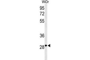 Western Blotting (WB) image for anti-Nicotinamide Riboside Kinase 1 (NMRK1) antibody (ABIN3004262) (NMRK1 Antikörper)