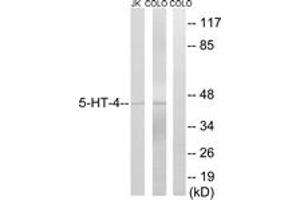 Western Blotting (WB) image for anti-Serotonin Receptor 4 (HTR4) (AA 21-70) antibody (ABIN2889848) (Serotonin Receptor 4 Antikörper  (AA 21-70))