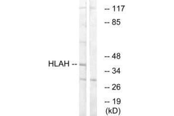 HLA-H Antikörper