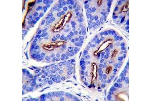 PSMA antibody immunohistochemistry analysis in formalin fixed and paraffin embedded human prostate carcinoma. (PSMA Antikörper  (AA 161-190))