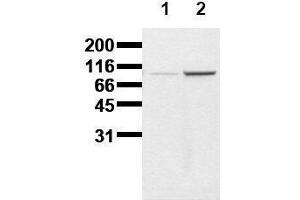 Western Blotting (WB) image for anti-Catenin (Cadherin-Associated Protein), beta 1, 88kDa (CTNNB1) (pTyr86) antibody (ABIN126740) (CTNNB1 Antikörper  (pTyr86))