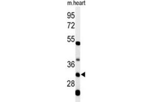 Western Blotting (WB) image for anti-Holocytochrome C Synthase (HCCS) antibody (ABIN3004361) (HCCS Antikörper)