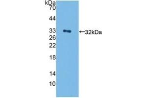 Detection of Recombinant ErbB4, Human using Polyclonal Antibody to Erb-b2 Receptor Tyrosine Kinase 4 (ErbB4) (ERBB4 Antikörper  (AA 29-278))
