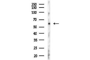 Western blot analysis of lysates from F10-LUC cells(uv30 min treatment), using Phospho-Lck (Tyr393)[Tyr394] Antibody at 1/1000 dilution.