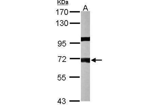 PPP1R16A Antikörper  (Center)