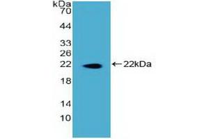 Detection of Recombinant DKC, Human using Polyclonal Antibody to Dyskerin (DKC) (DKC1 Antikörper)