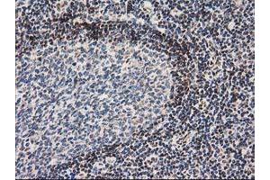 Image no. 3 for anti-Nonhomologous End-Joining Factor 1 (NHEJ1) antibody (ABIN1499729) (NHEJ1 Antikörper)