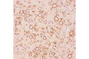 Immunohistochemistry (IHC) image for anti-Potassium Voltage-Gated Channel, Shab-Related Subfamily, Member 1 (KCNB1) (AA 687-858) antibody (ABIN3043866)