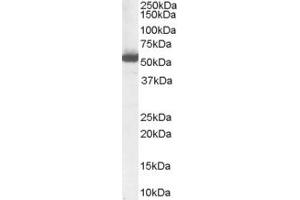 Western Blotting (WB) image for anti-Dehydrodolichyl Diphosphate Synthase (DHDDS) (C-Term) antibody (ABIN2783566)
