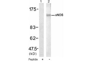 Image no. 1 for anti-Nitric Oxide Synthase 3 (Endothelial Cell) (NOS3) (Ser1177) antibody (ABIN319319) (ENOS Antikörper  (Ser1177))