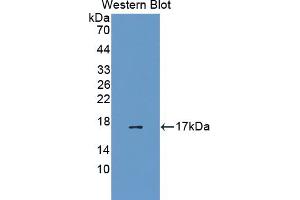 Western blot analysis of the recombinant protein. (EEA1 Antikörper  (AA 1232-1348))