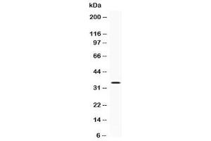 Western blot testing of human A431 cell lysate with NAT1 antibody at 0. (NAT1 Antikörper  (AA 172-201))