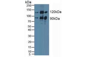 Western blot analysis of (1) Human HeLa cells, (2) Mouse Brain Tissue and (3) Porcine Brain Tissue. (PKC epsilon Antikörper  (AA 403-672))