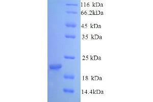 Caveolin 1, Caveolae Protein, 22kDa (CAV1) (AA 1-178) protein (His tag) (Caveolin-1 Protein (AA 1-178) (His tag))