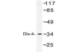 Western blot (WB) analysis of Dlx-4 antibody in extracts from COLO cells. (DLX4 Antikörper)