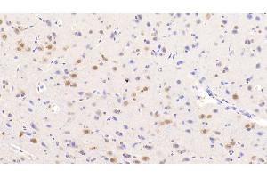 Detection of NOVA1 in Human Cerebrum Tissue using Polyclonal Antibody to Neuro Oncological Ventral Antigen 1 (NOVA1) (NOVA1 Antikörper  (AA 295-510))