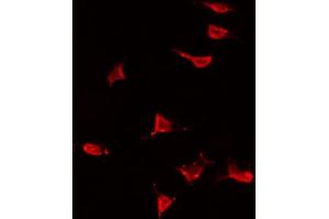 ABIN6266704 staining HeLa by IF/ICC. (MAP3K13 Antikörper  (N-Term))