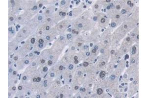 Detection of AHNAK in Human Liver Tissue using Polyclonal Antibody to Desmoyokin (AHNAK) (AHNAK Antikörper  (AA 1-300))