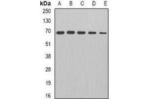 Western blot analysis of PDC-E2 expression in HepG2 (A), Jurkat (B), mouse heart (C), rat brain (D), rat kidney (E) whole cell lysates. (DLAT Antikörper)