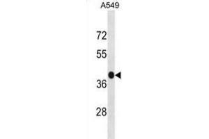 Western Blotting (WB) image for anti-G Protein-Coupled Receptor 77 (GPR77) antibody (ABIN3001276) (GPR77 Antikörper)