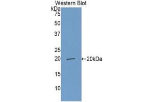 Western blot analysis of the recombinant protein. (CFP Antikörper  (AA 315-469))