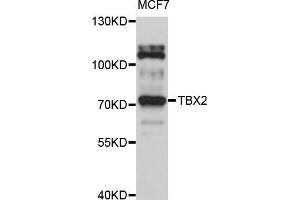 Western blot analysis of extracts of MCF-7 cells, using TBX2 antibody (ABIN5999016) at 1/1000 dilution. (TBX2 Antikörper)